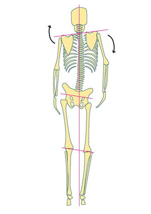 Fibromyalgie durch falschen Biss