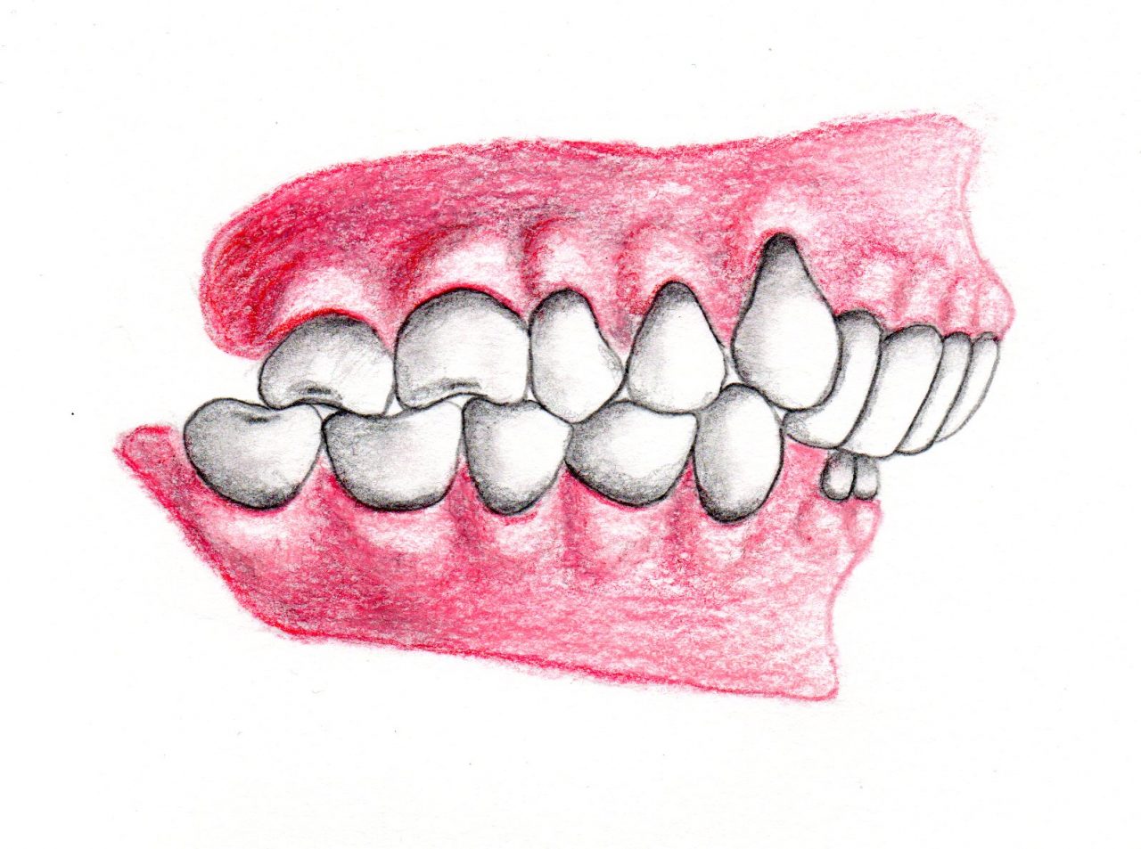 Zahn und Kieferfehlstellung Dr Morlok